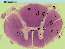 Thoracic