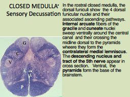 CLOSED MEDULLA  Sensory Decussation