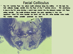 Facial Colliculus