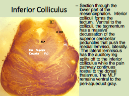 Inferior Colliculus