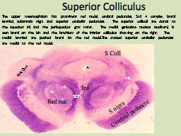 Superior Colliculus