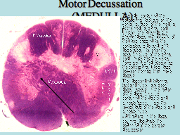 Motor Decussation  (MEDULLA)