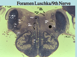 Foramen Luschka/9th Nerve