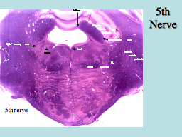 5th Nerve