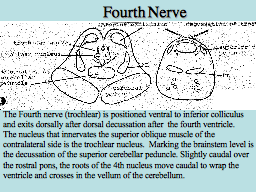 Fourth Nerve