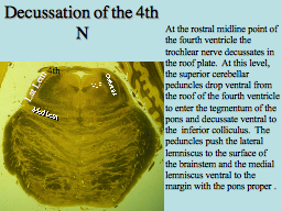 Decussation of the 4th N