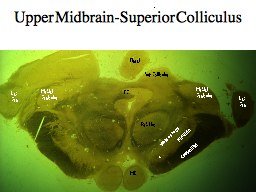 Upper Midbrain-Superior Colliculus