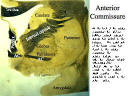 Slide 10